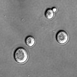 CLASSIFICATION DU MONDE MICROBIEN FAMILLES MICROBIENNES MORPHOLOGIE CARACTERISTIQUES EXEMPLES