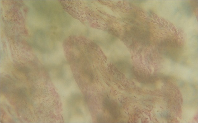 HISTOLOGY OF GONADS IN TILAPIA ZILLII (GERVAIS) FED NEEM