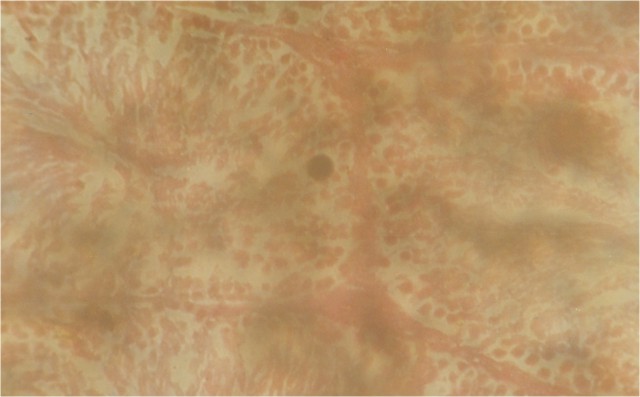 HISTOLOGY OF GONADS IN TILAPIA ZILLII (GERVAIS) FED NEEM